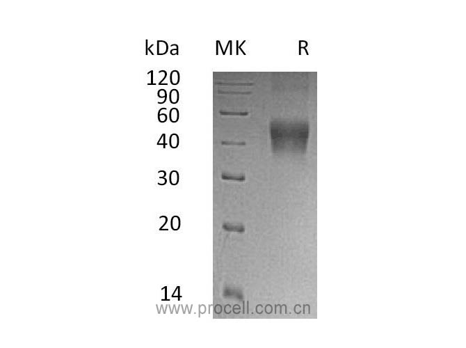 Procell-IL-21R/ CD360, Human, Recombinant