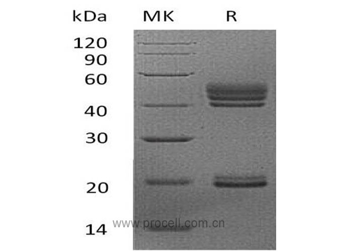 IL-23/ NKSF2 (C-6His), Human, Recombinant