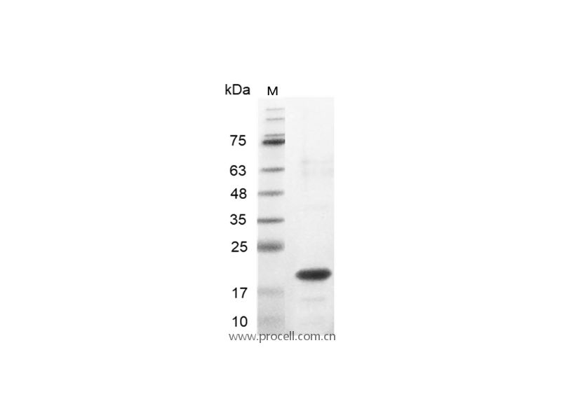 IL-33/IL-1F11, Human, Recombinant