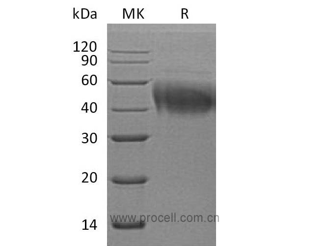 Procell-IL-4Rα/ CD124 (C-6His), Human, Recombinant