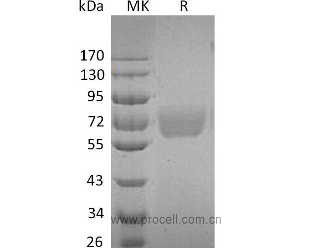 IL-4Rα/ CD124 (C-Fc), Human, Recombinant