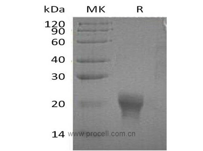 Procell-IL-5 (C-6His), Human, Recombinant