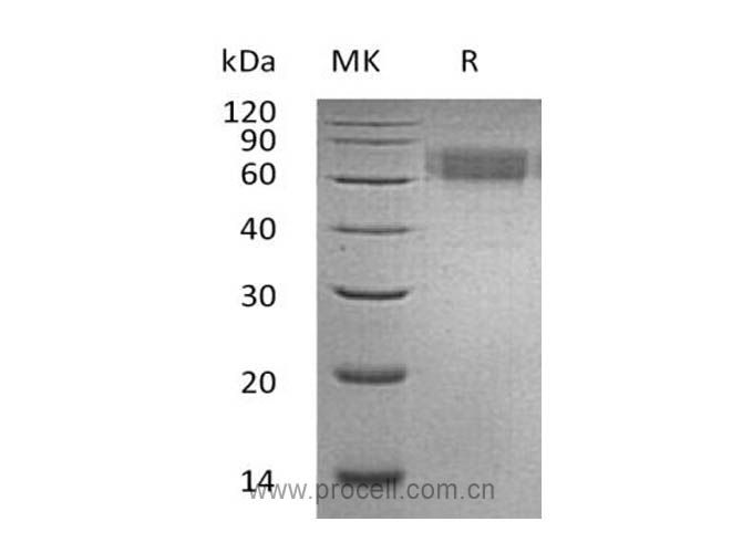 IL-6Rα/ CD126, Human, Recombinant