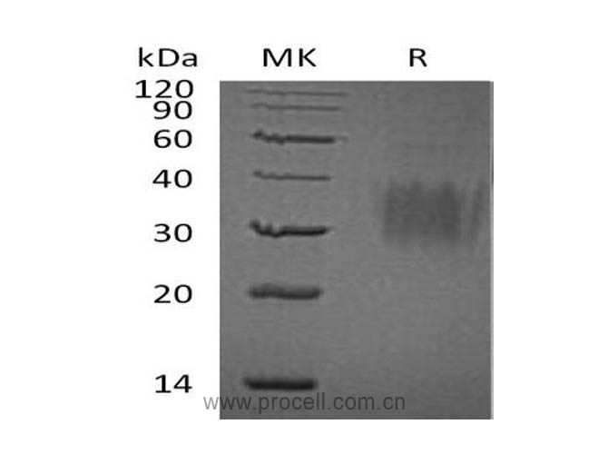 IL-9/ Cytokine P40 (C-6His), Human, Recombinant