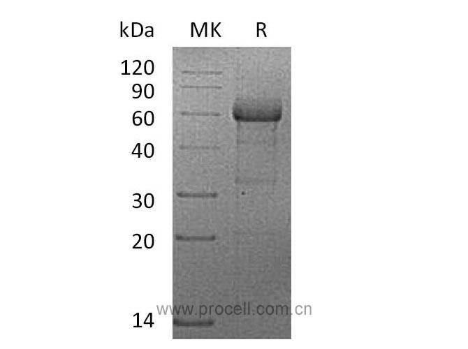 TNF-R2/ CD120b/ TNFRSF1B (C-mFc), Human, Recombinant