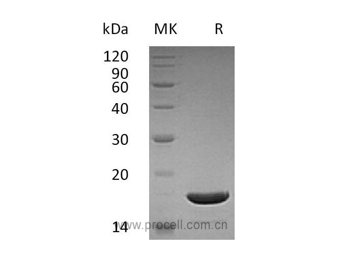 Procell-CD253/ TNFSF10/ TRAIL, Human, Recombinant