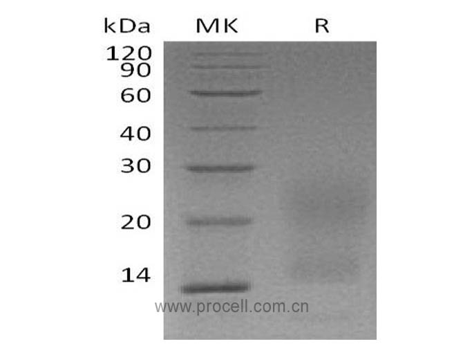 TNFRSF17/ BCMA/ CD269 (C-6His), Human, Recombinant