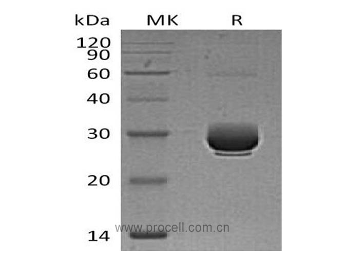 ANGPTL3 (Ser17-Thr206) (C-6His), Mouse, Recombinant