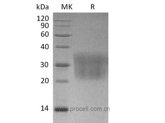 MCP-1/ CCL2 (C-6His), Mouse, Recombinant