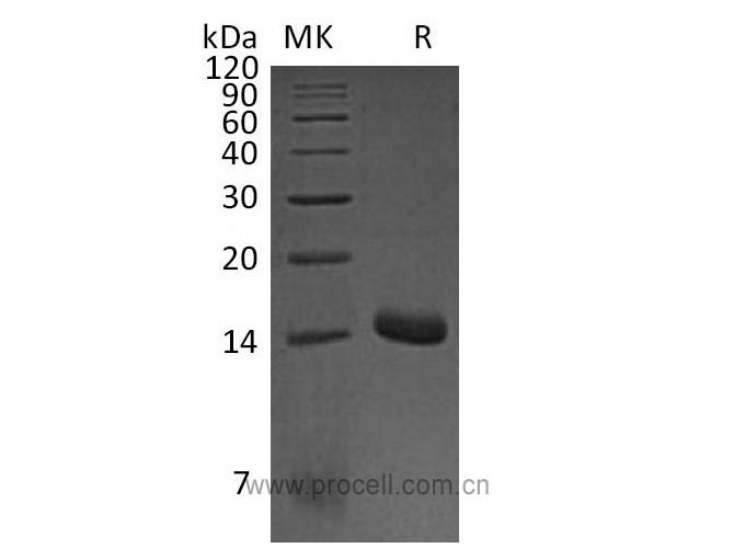 MIP-1α/ CCL3 (N-6His), Mouse, Recombinant