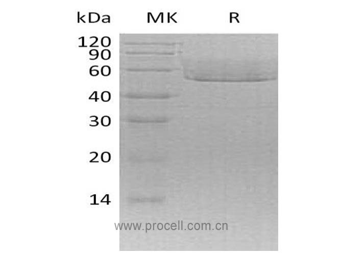 Fractalkine/ CX3CL1 (C-6His), Mouse, Recombinant