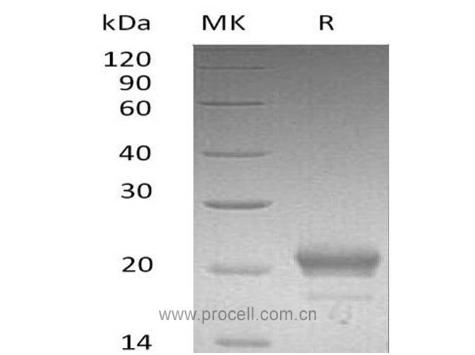 CXCL15/ Lungkine (C-6His), Mouse, Recombinant