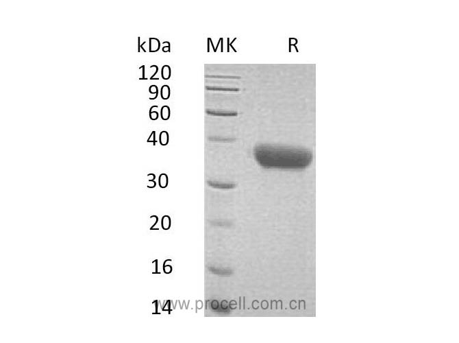 Procell-CXCL16/ SR-PSOX (C-6His), Mouse, Recombinant