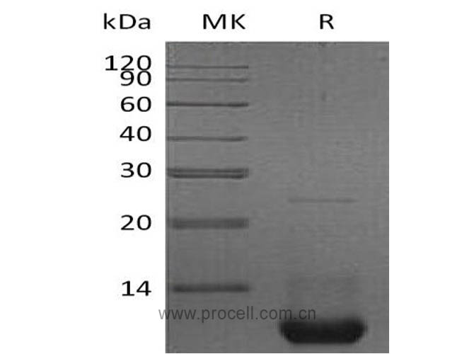CXCL2/ MIP-2 / GRO-β, Mouse, Recombinant