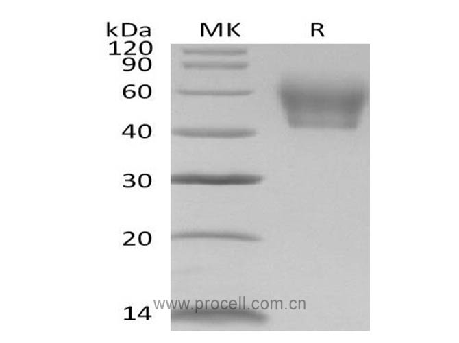 IL-1R-2/ CD121b (C-6His), Mouse, Recombinant