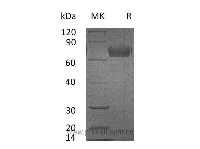 IL-4Rα (C-Fc), Mouse, Recombinant