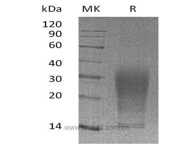 IL-13 (Pro22-Phe131, C-6His), Mouse, Recombinant