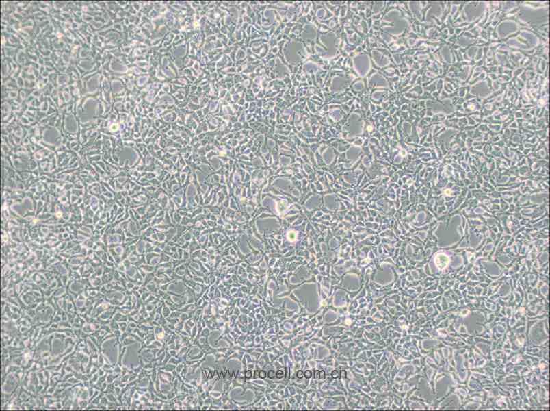 293 [HEK-293] (人胚肾细胞) (STR鉴定正确)