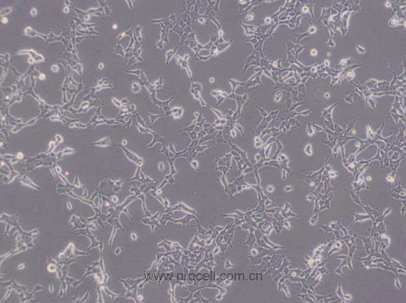 293 [HEK-293] (人胚肾细胞) (STR鉴定正确)