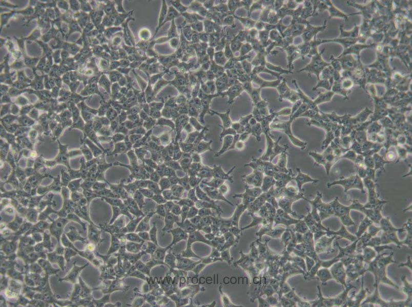 293T [HEK-293T](人胚肾细胞) (STR鉴定正确)