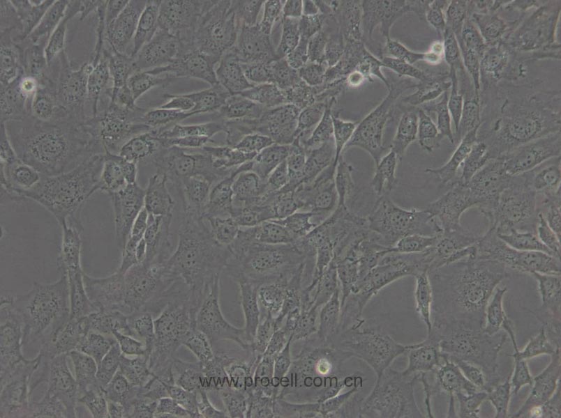 3T3-L1 (小鼠胚胎成纤维细胞) (种属鉴定正确)