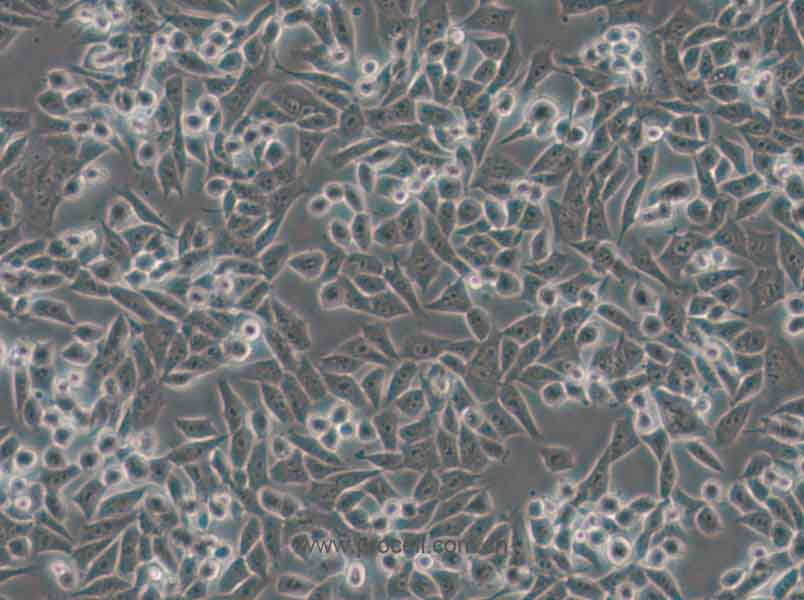 4T1(小鼠乳腺癌细胞) (STR鉴定正确)