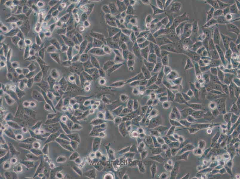 4T1 (小鼠乳腺癌细胞) (STR鉴定正确)