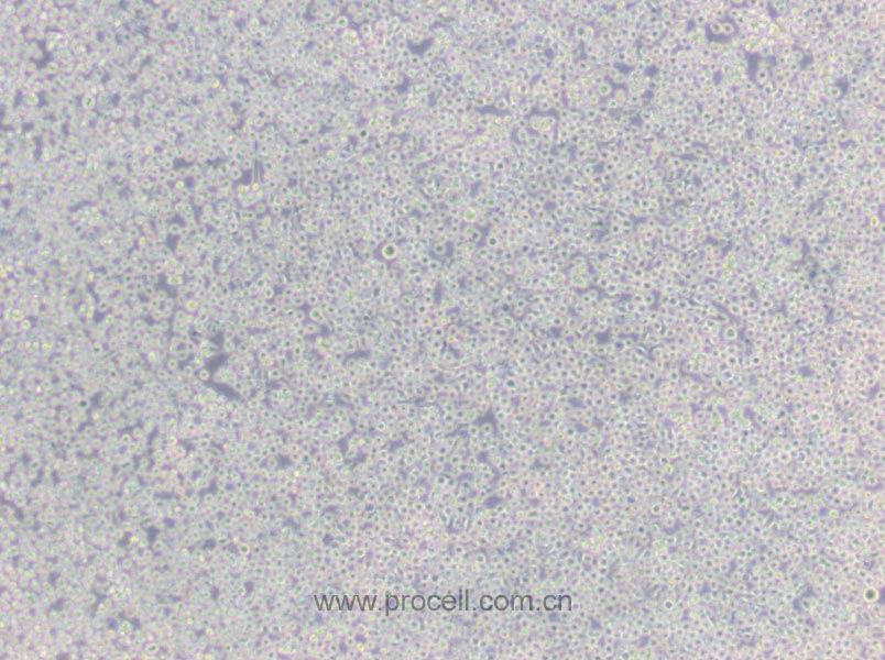 6T-CEM (人T细胞白血病细胞) (STR鉴定正确)