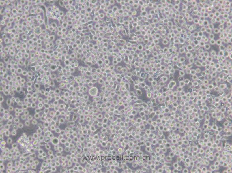 6T-CEM (人T细胞白血病细胞) (STR鉴定正确)
