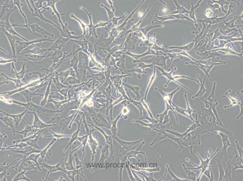 A172 (人胶质母细胞瘤细胞) (STR鉴定正确)