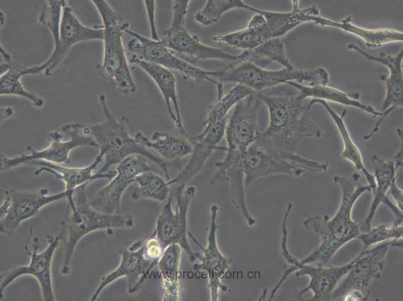 A172 (人胶质母细胞瘤细胞) (STR鉴定正确)