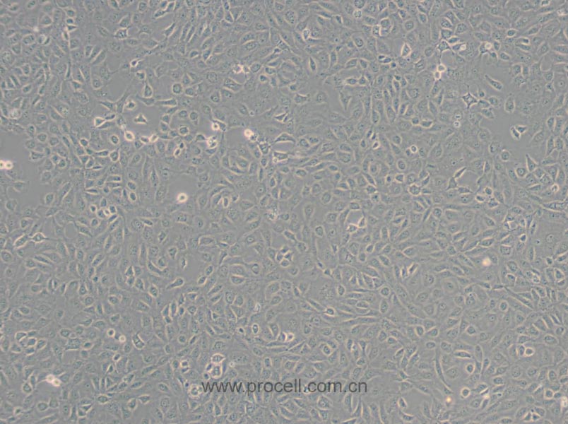 ARPE-19 (人视网膜上皮细胞) (STR鉴定正确)