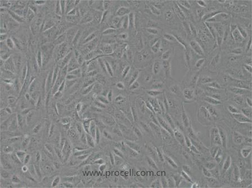 ARPE-19 (人视网膜上皮细胞) (STR鉴定正确)