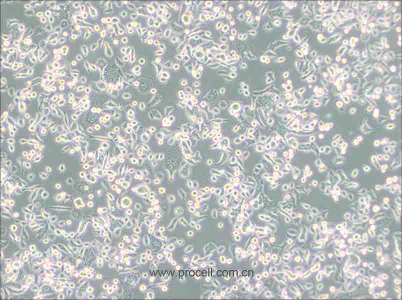 AsPC-1 (人转移胰腺腺癌细胞) (STR鉴定正确)