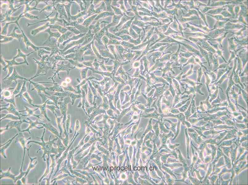 B16 (小鼠黑色素瘤细胞) (种属鉴定正确)
