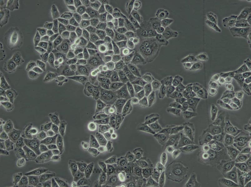 BGC-823 (人胃腺癌细胞(低分化)) (Hela污染细胞系，暂不供应)