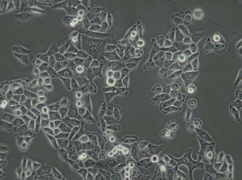 BGC-823 (人胃腺癌细胞(低分化)) (Hela污染细胞系，暂不供应)
