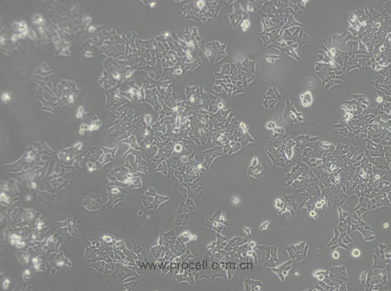 BIU-87 (人膀胱癌细胞) (STR鉴定正确)(暂不出售，污染细胞系）