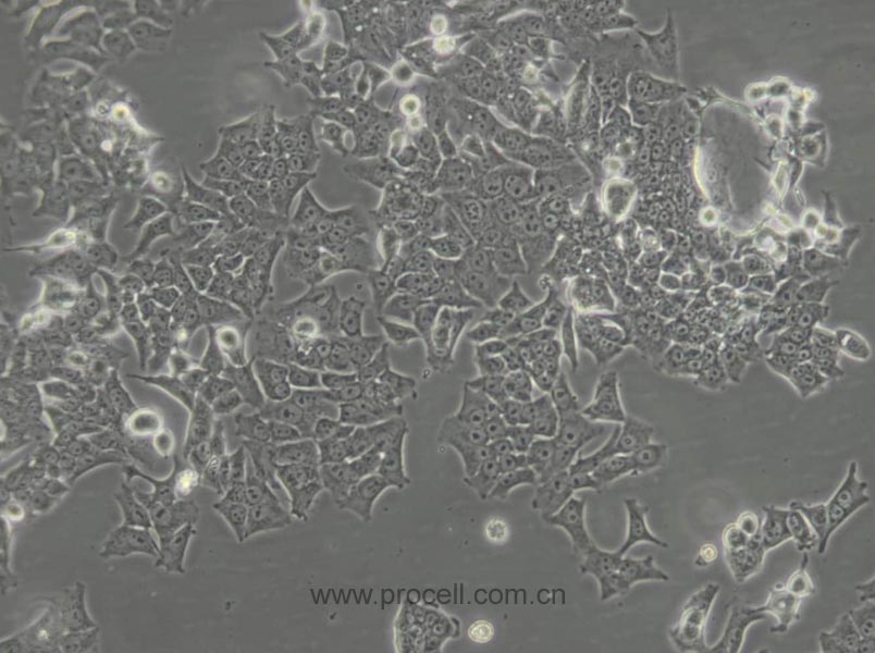 BIU-87 (人膀胱癌细胞) (STR鉴定正确)(暂不出售，污染细胞系）
