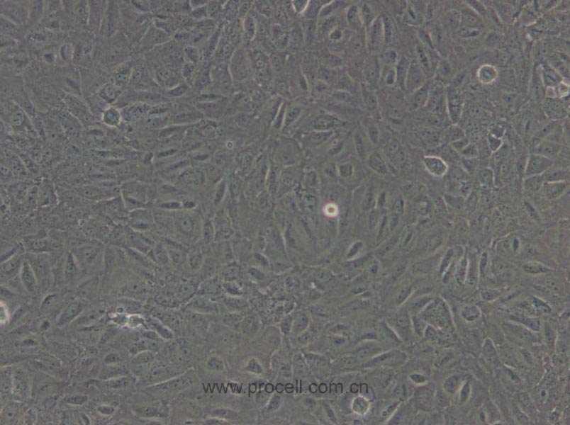 BRL 3A (大鼠肝细胞) (种属鉴定正确)