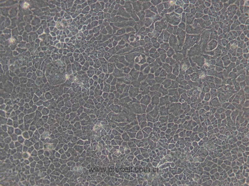 BNL CL.2 (小鼠胚胎肝细胞) (种属鉴定正确)