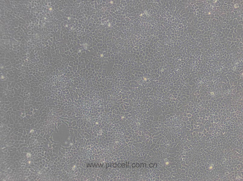 BNL CL.2 (小鼠胚胎肝细胞) (STR鉴定正确)