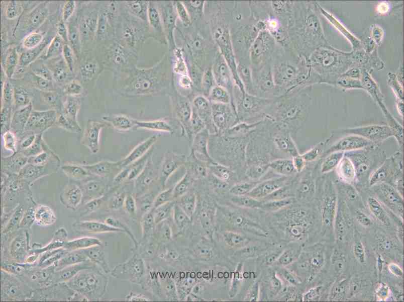 BS-C-1 (非洲绿猴肾细胞)(种属鉴定正确)