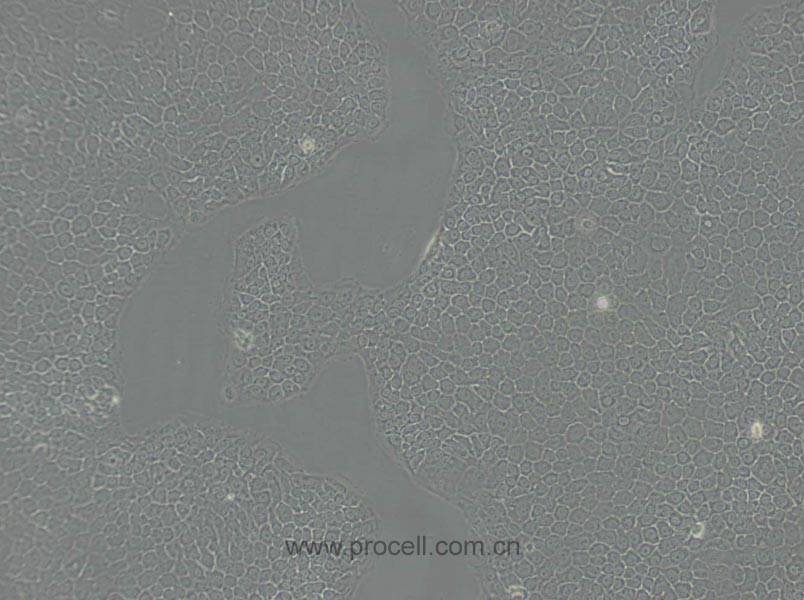 BxPC-3 (人原位胰腺腺癌细胞) (STR鉴定正确)