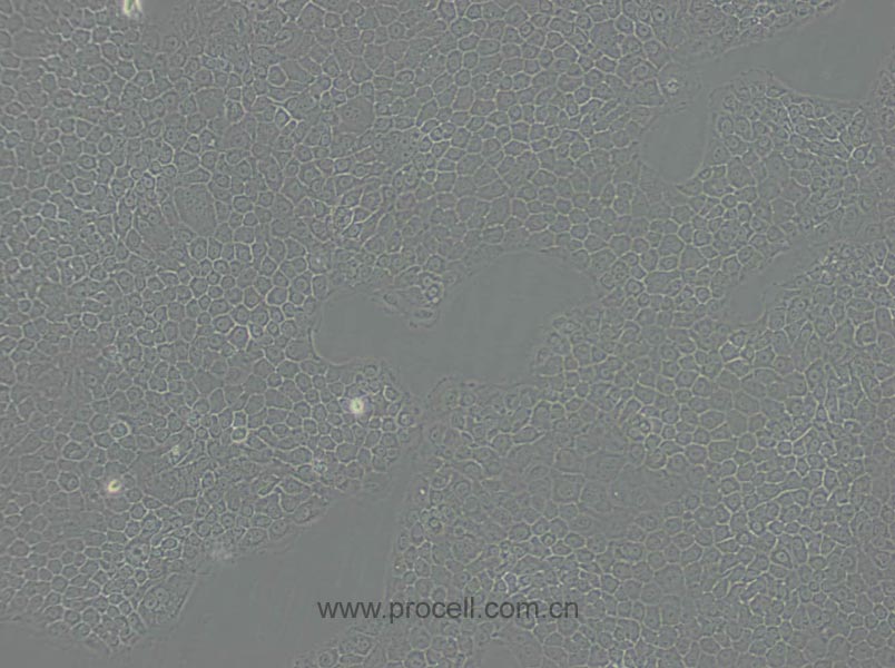 BxPC-3 (人原位胰腺腺癌细胞) (STR鉴定正确)