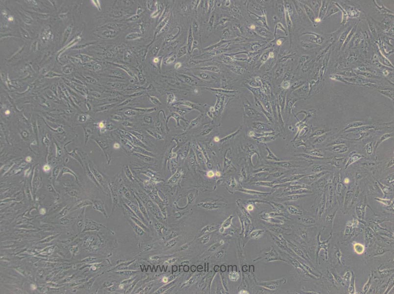 Caki-1 (人肾透明细胞癌皮肤转移细胞) (STR鉴定正确)