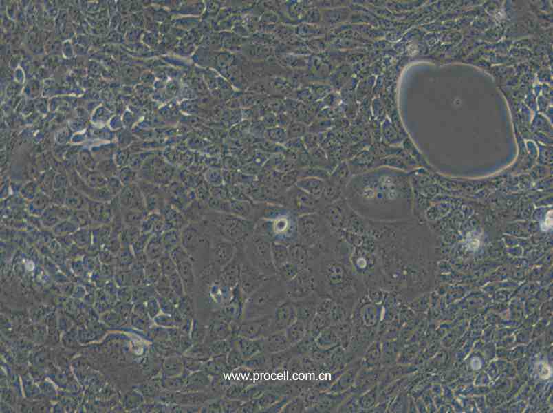 Calu-3 (人肺腺癌细胞(胸水)) (STR鉴定正确)