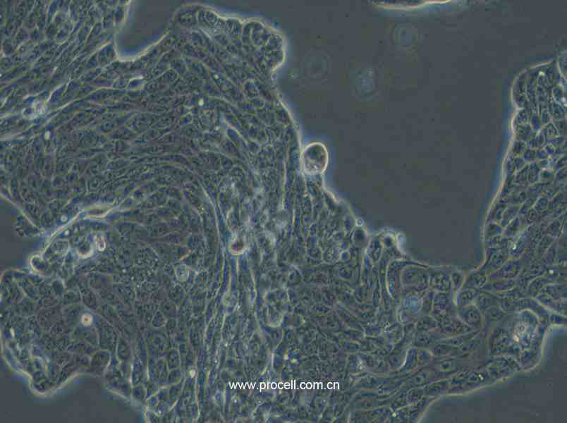Calu-3 (人肺腺癌细胞(胸水)) (STR鉴定正确)