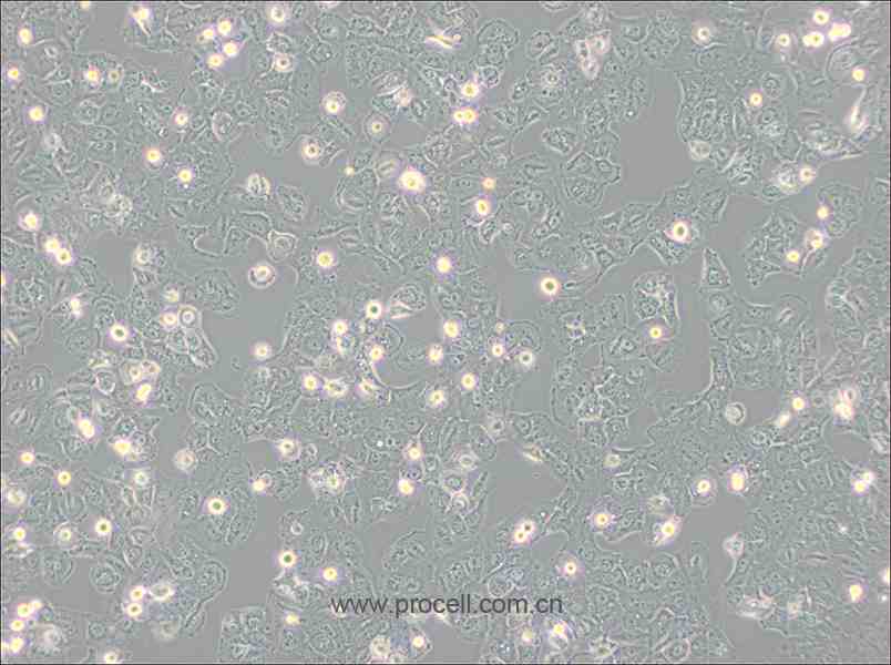 Caov-3 (人乳突状卵巢腺癌细胞) (STR鉴定正确)