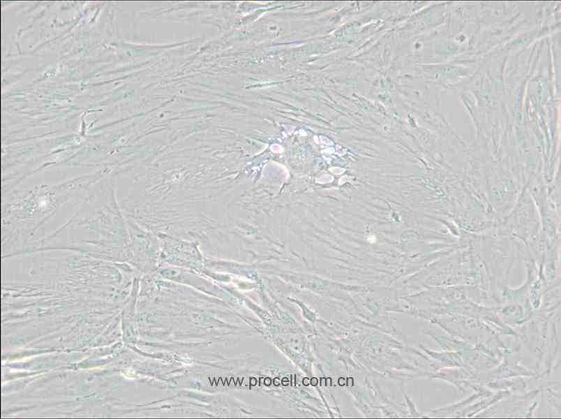 CCD-1095Sk (人乳腺浸润性导管癌旁皮肤细胞) (STR鉴定正确)